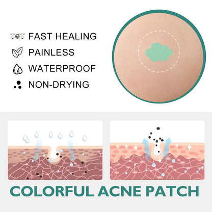 Colorful Acne Patch, Repair Pit Acne Print Smooth Skin Lightening Spot Clear Acne Facial