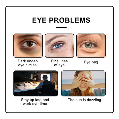 Eye Roller Eye Cream Ball Massage To Reduce Fine Lines, Bags, Puffiness And Dark Circles Around The Eyes