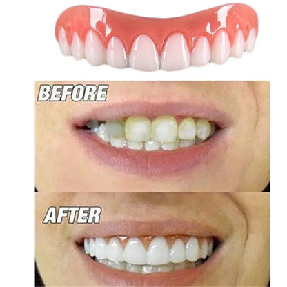 Upper and Lower Teeth Silicone Artificial Teeth Braces