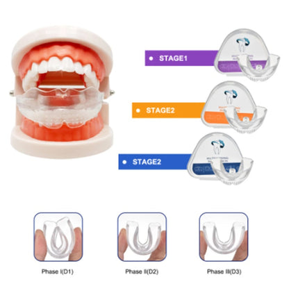 Silicone Sports Braces Mouth Breathing Braces Braces
