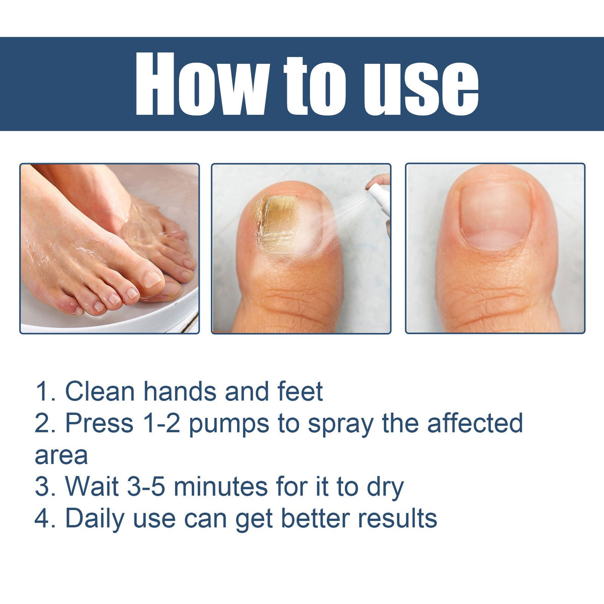 Nail Care Spray Gently Cleans Foot Nails Moisturizing And Brightening Nail Care Spray