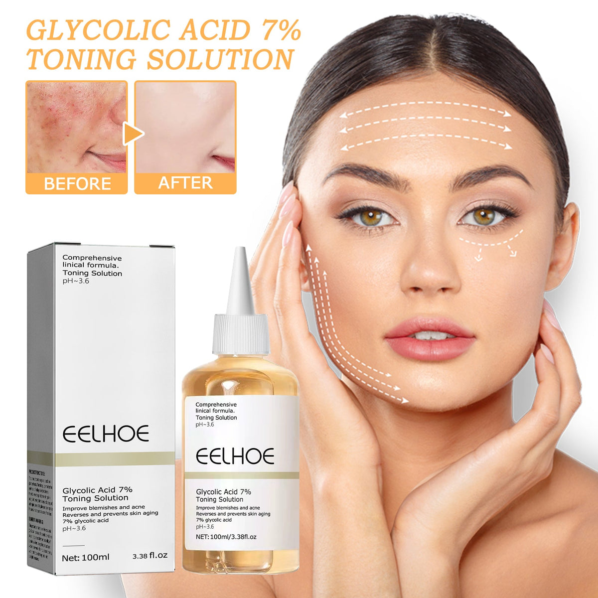 Glycolic Acid 7% Toner, Remove Acne Lighten Acne Repair Acne Mark Moisturize Skin Toner