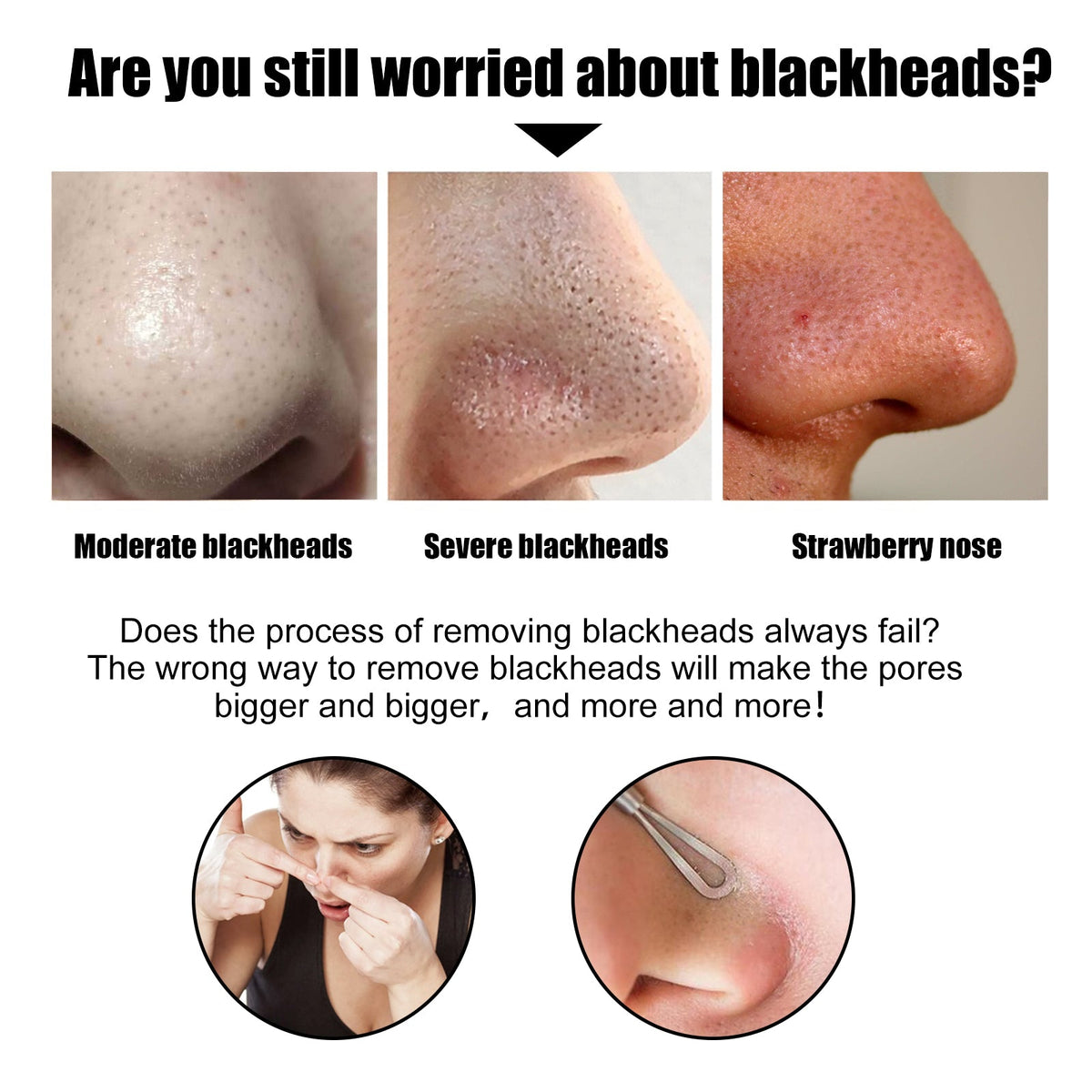 Black Pig Nose Patch, Bamboo Charcoal Remove Blackhead Acne Tear Nose Mask Patch