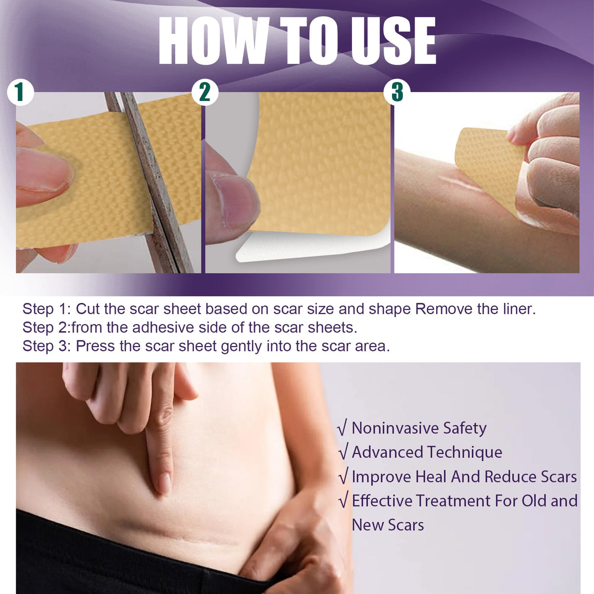 Silicone Scar Patch, Reduces Stretch Marks And Hyperplasia Of Caesarean Section Scars Silicone Patch