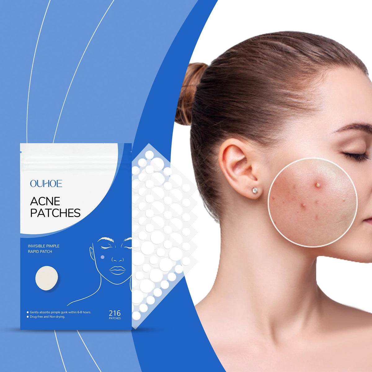 Acne Patch Gentle Facial Care