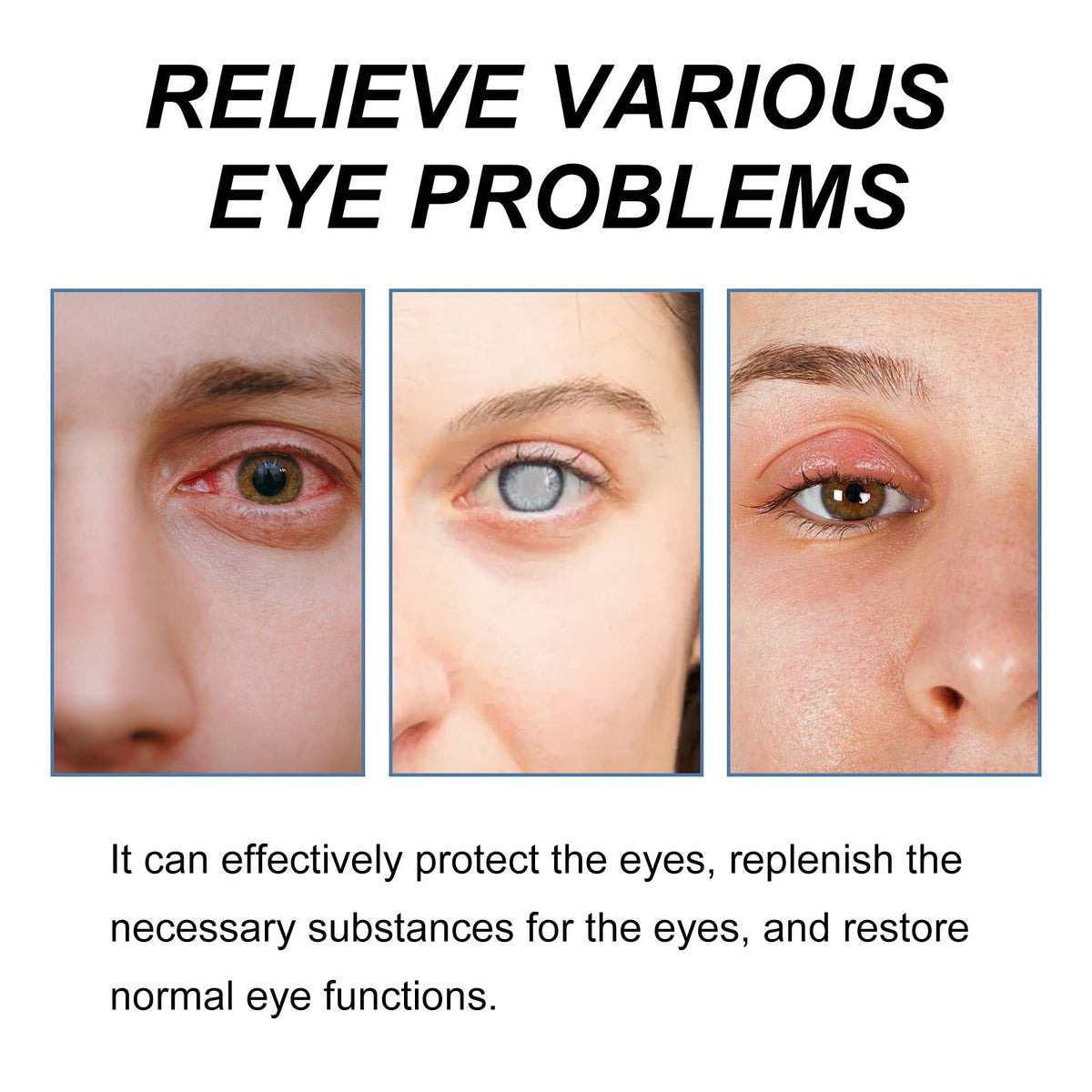 Ximonth Eye Care Solution Gentle And Moisturizing Daily Eye Care Solution For Comfort And Hydration