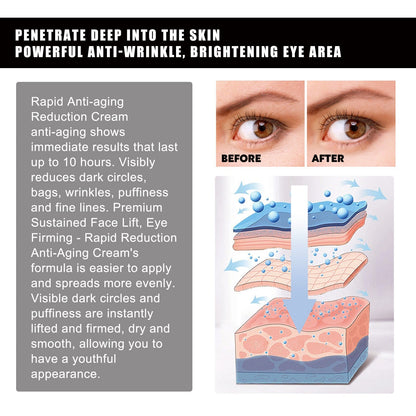 Aloe Vera Eye Gel Patch Reduces Fine Lines Under Eyes, Dark Circles Under Eyes, Firming Eyes, Anti-Wrinkle And Moisturizing Eye Patch
