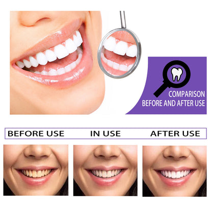 Teeth Whitening Toothpaste, Removing Teeth Stains And Odors Oral Care Brightening And Whitening Teeth Toothpaste