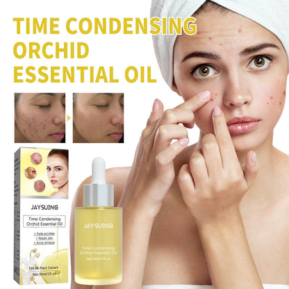 Orchid Acne Essential Oil Cleans And Brightens Pores And Hydrates Facial Care Essence