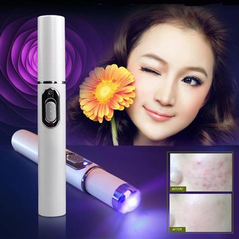 Blue Light Acne Laser Pen