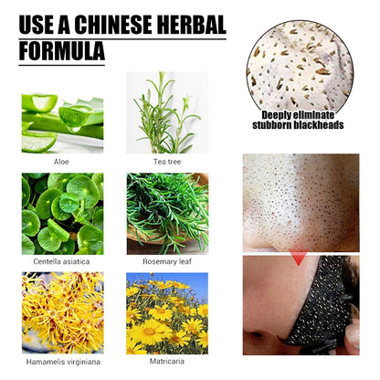 Blackhead Removal Mask, Peel Off Remove Blackhead Activated Carbon Cleansing Face Mask