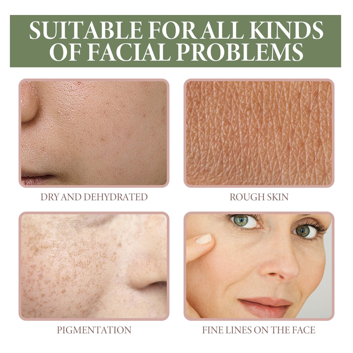 5% Niacinamide Serum, Chun White Tender Skin Fade Spots Brighten Moisturizing Skin Fine Pores