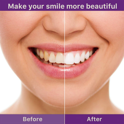 Tooth Cleaning Mousse, Anti-Decay Clean Teeth Tartar Breath Fresh Whitening Teeth Toothpaste