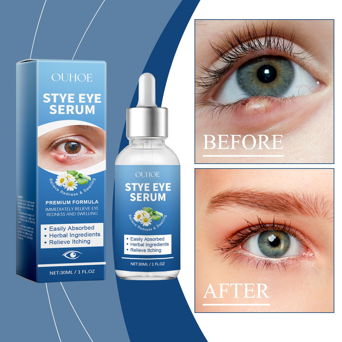 Eye Care Solution, A Gentle Moisturizing Eye Solution That Relieves Acidness, Is A Daily Portable Eye Care Drops
