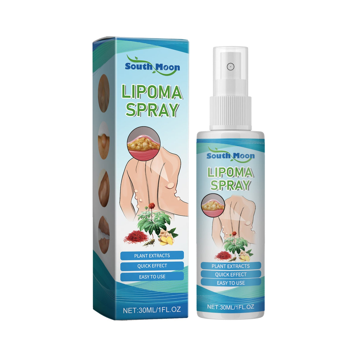 Lipoma Spray, Body Subcutaneous Fat Dredging Treatment To Relieve Lumps And Clumps