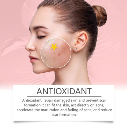 Repair Acne Patch, Facial Cleansing Cover Acne Skin Moisturizing Gentle Skin Cream