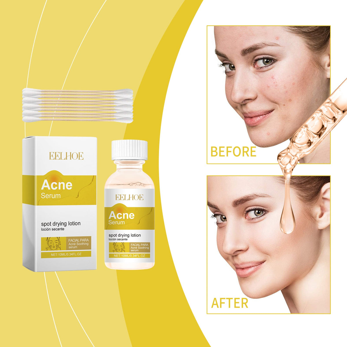 Face Essence Improve Acne Muscle Acne Closing Gentle Cleansing Face Skin Face Essence