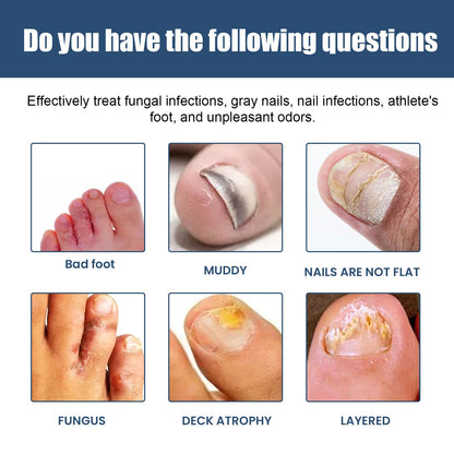 Nail Care Spray Gently Cleans Foot Nails Moisturizing And Brightening Nail Care Spray