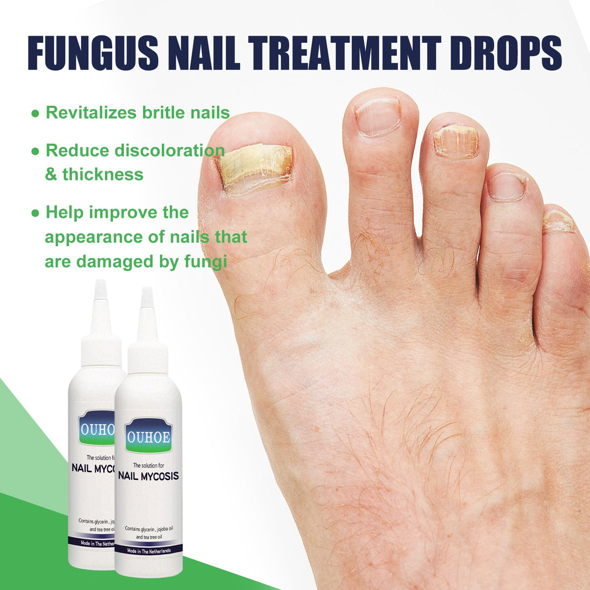 Gray Nail Repair Drops, Repair Hand And Foot Gray Nails Soft And Bright Nail Thickening Nail Care Solution