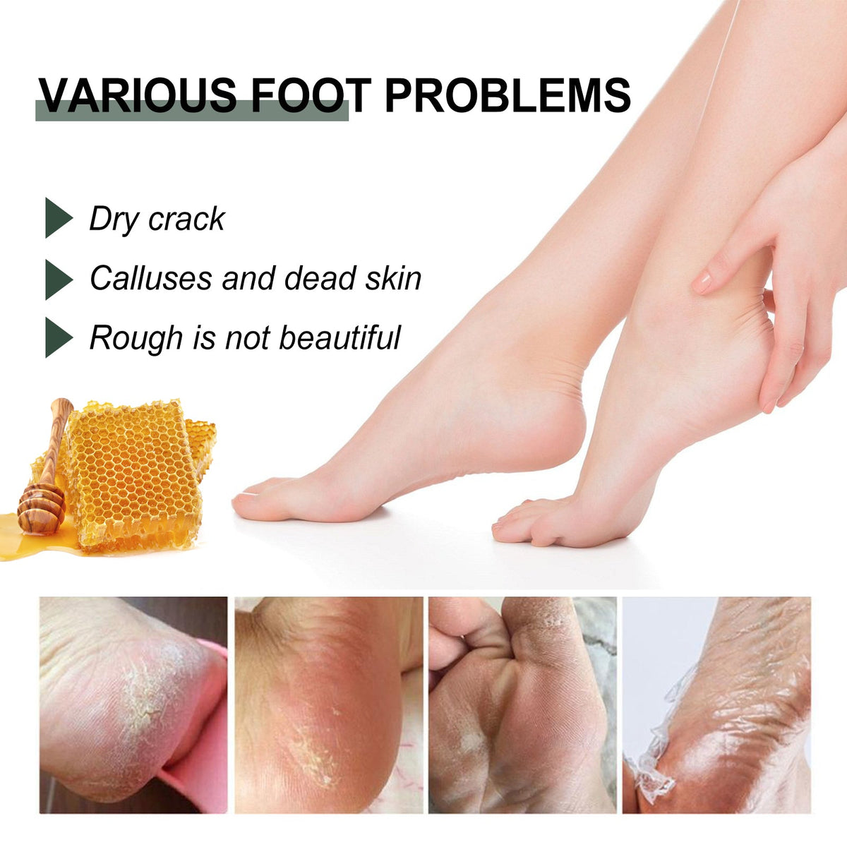 Anti-Crack Hand And Foot Care Cream Moisturizes Skin To Prevent Dry Cracking, Peeling, Freezing And Chapping