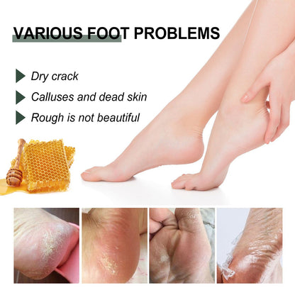 Anti-Crack Hand And Foot Care Cream Moisturizes Skin To Prevent Dry Cracking, Peeling, Freezing And Chapping