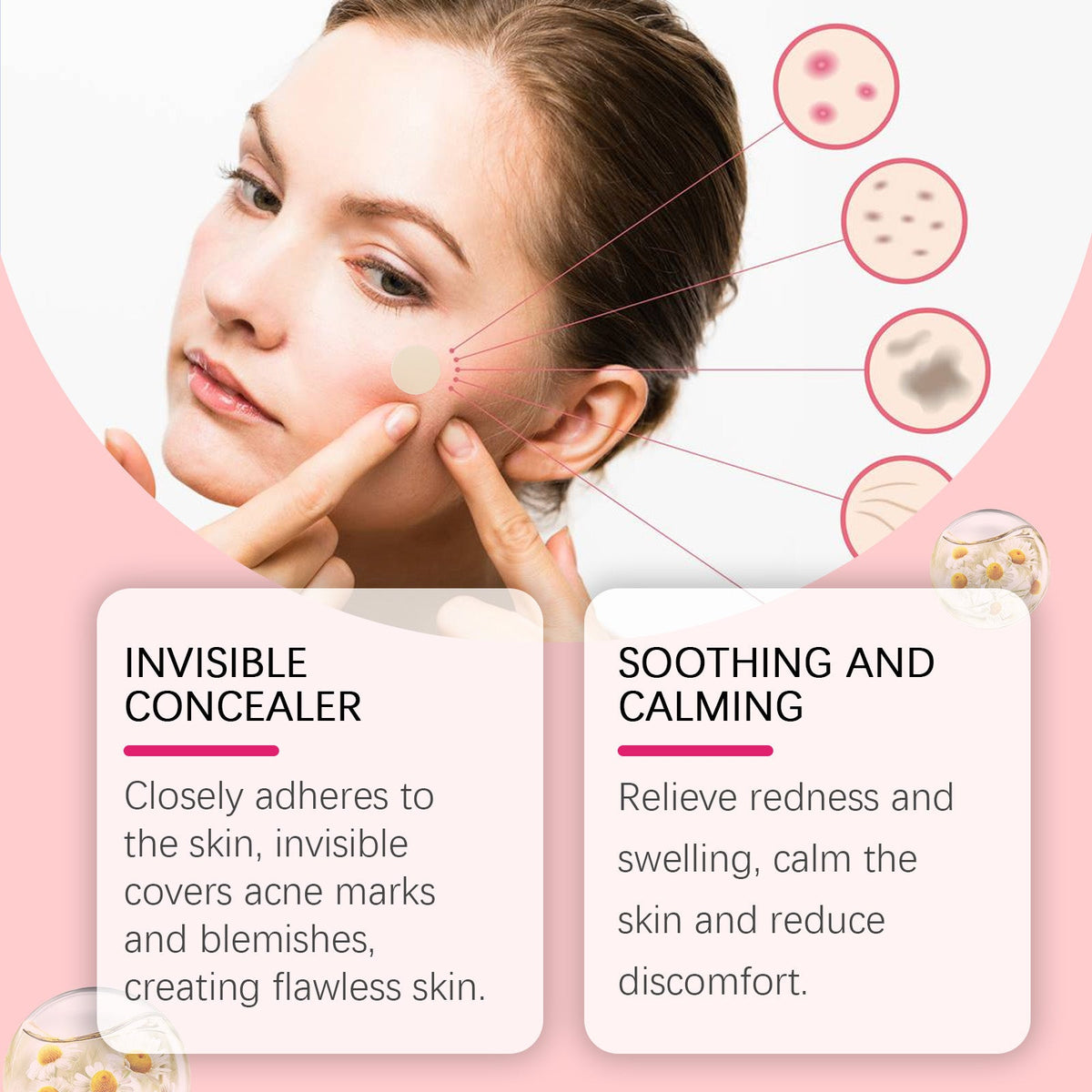 Repair Acne Patch, Facial Cleansing Cover Acne Skin Moisturizing Gentle Skin Cream