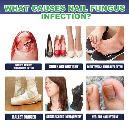 Gray Nail Repair Drops, Repair Hand And Foot Gray Nails Soft And Bright Nail Thickening Nail Care Solution