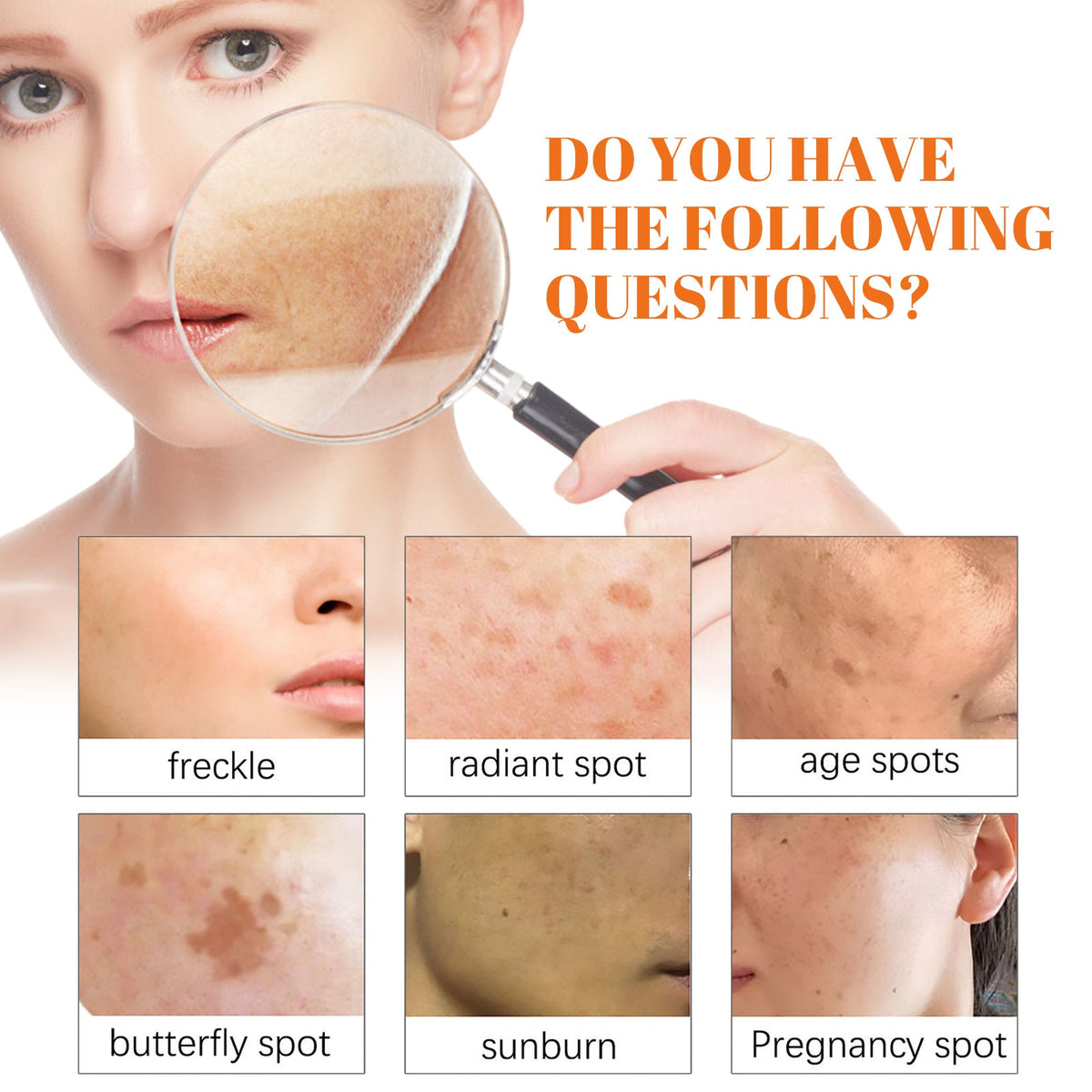 Papaya Whitening Freckle Cream Lightens Dark Spots On The Face, Brightens And Moisturizes The Skin Early And Late