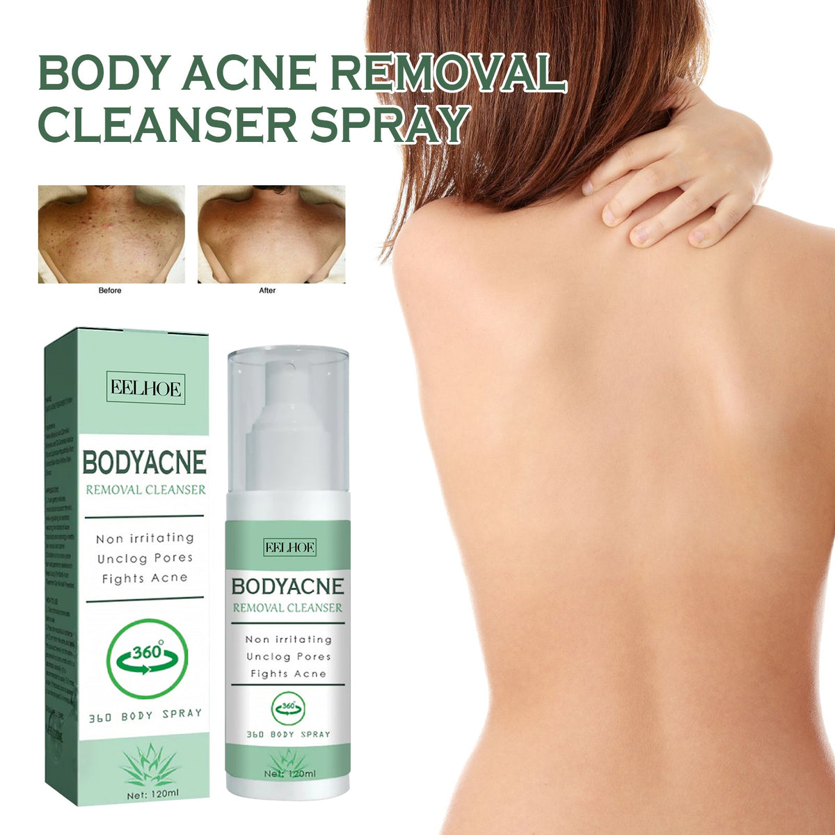 Body Acne Removal Cleanser Spray, Deep Clean Back Arm Fade Acne Beauty Moisturizing Spray