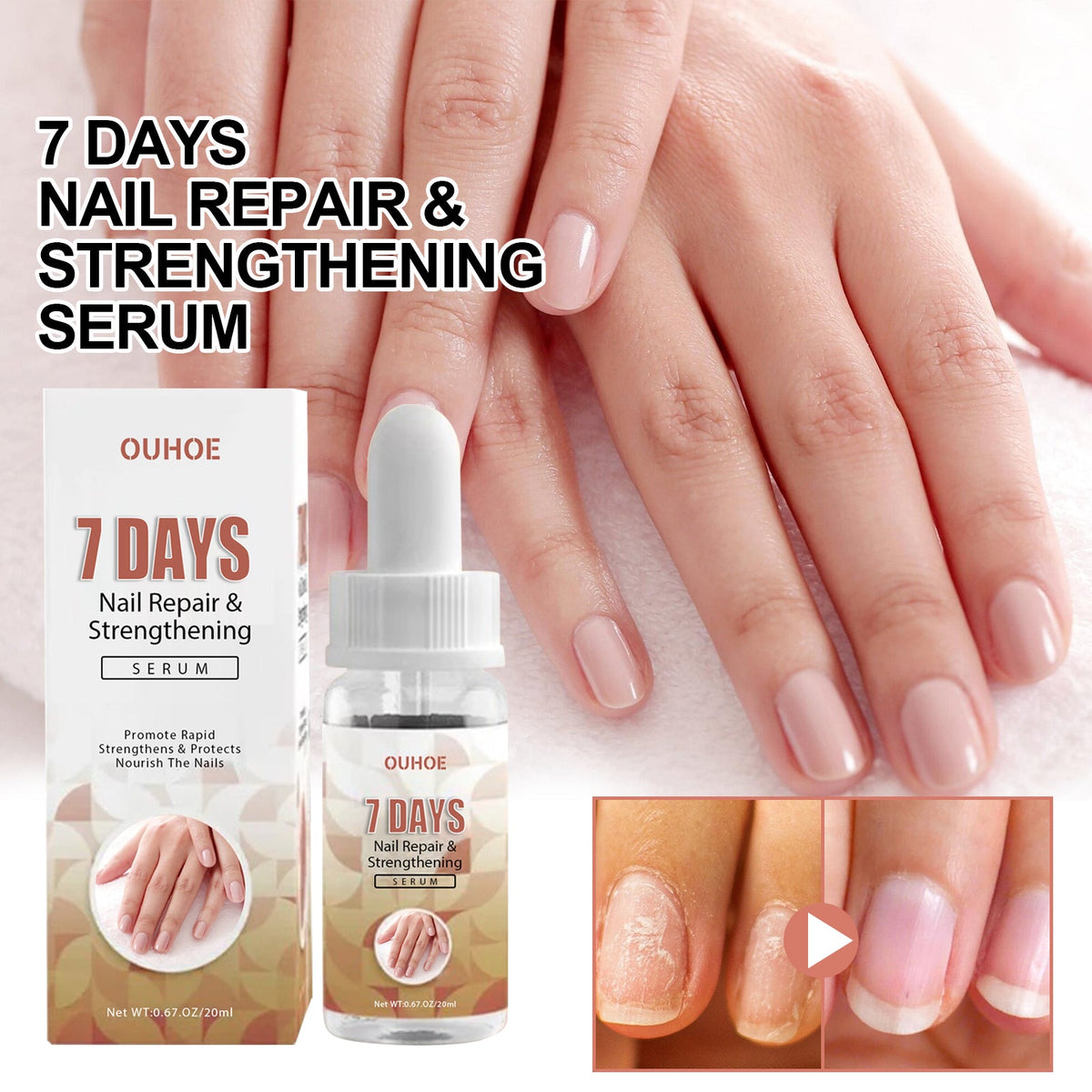 7 Day Nail Repair Essence, Hand And Foot Gray Nail Brightening Soft Nail Thickening Toenail Care Solution
