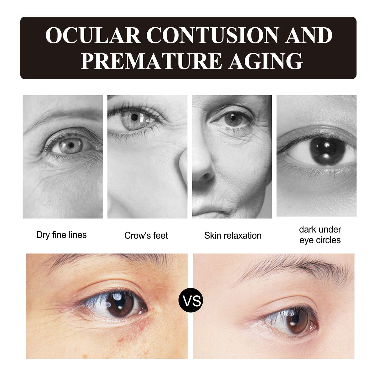 Retinol Eye Cream, Desalination Smoothen Fine Lines Eye Pouch Black Rim Of The Eye Moist Nursing Play Tight Muscle Eye Cream