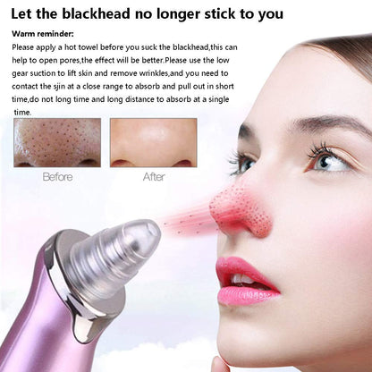 Electric Blackhead Vacuum Suction Cleaner