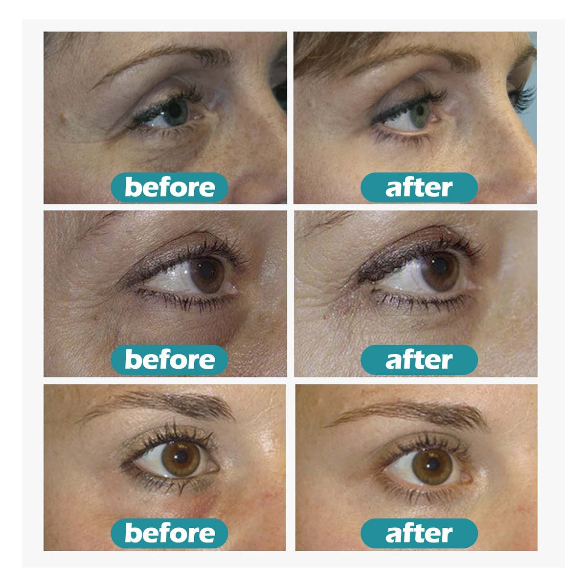 Fade Eye Pattern Care Gel Repair Eye Bag