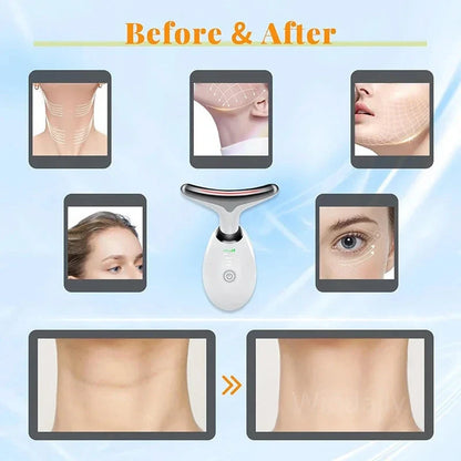 Lift Lush Face Massager